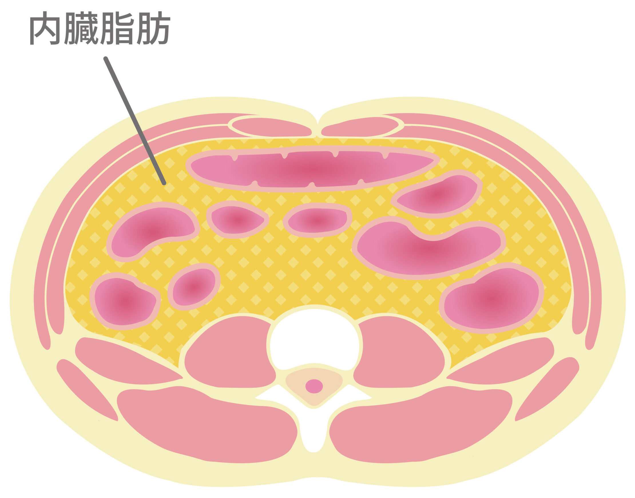 内臓脂肪型肥満