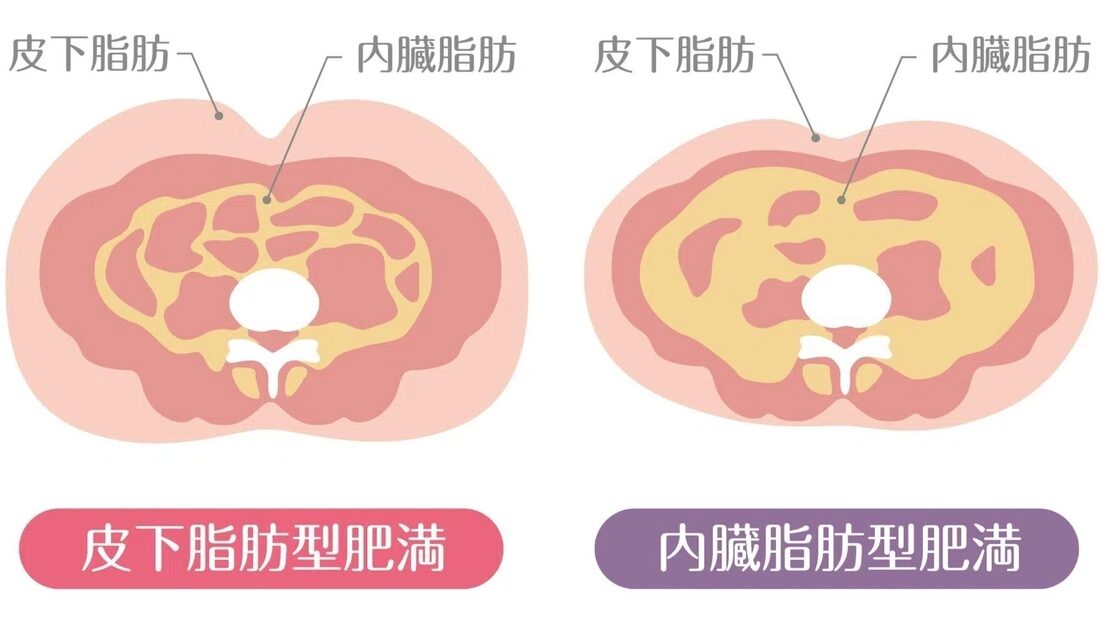 内臓脂肪と皮下脂肪